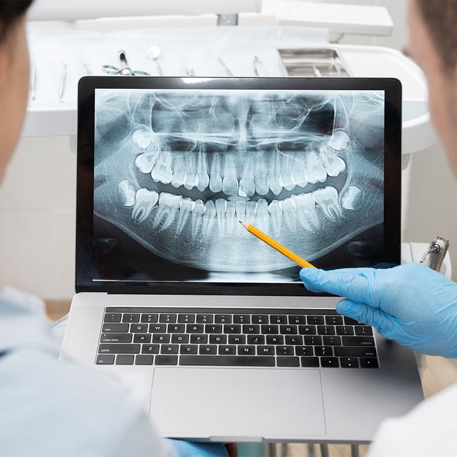 VASPJ | Blog - ORTOPANTOMOGRAFIA (OPG): QUAIS ERROS EVITAR PARA OBTER UMA IMAGEM DE QUALIDADE